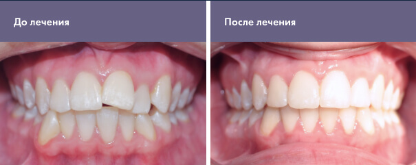 Пациенту 22 года